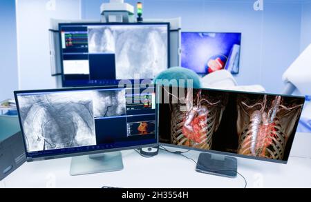 Vue rapprochée de la salle de contrôle des vaisseaux cardiaques (vaisseaux coronaires) sur le moniteur dans le laboratoire de radiologie en fonctionnement. Fond flou de la salle d'opération Banque D'Images