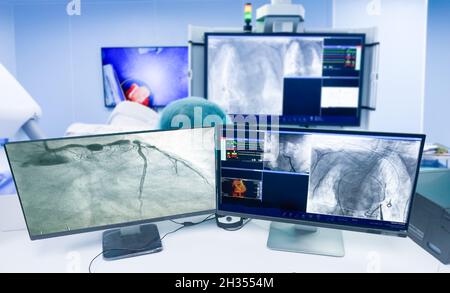 Vue rapprochée de la salle de contrôle des vaisseaux cardiaques (vaisseaux coronaires) sur le moniteur dans le laboratoire de radiologie en fonctionnement. Fond flou de la salle d'opération Banque D'Images