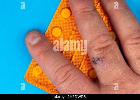 Sutures postopératoires sur le doigt de la main.Points de suture sur le doigt blessé.Photo prise sous lumière artificielle Banque D'Images