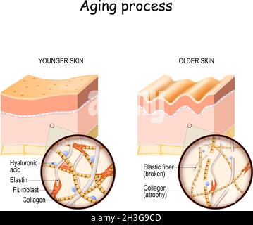Processus de vieillissement. Comparaison et différence entre la peau plus jeune et plus ancienne.Couches de la peau et gros plan de l'élastine, des fibres de collagène, de l'acide hyaluronique Illustration de Vecteur