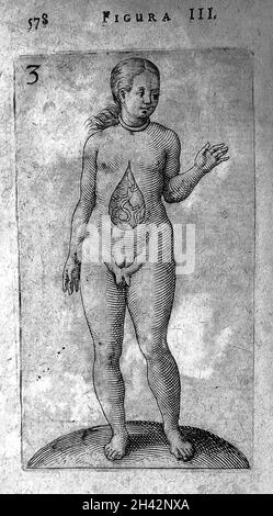 Hermaphrodite de Hermaphroditorum, 1614 Banque D'Images