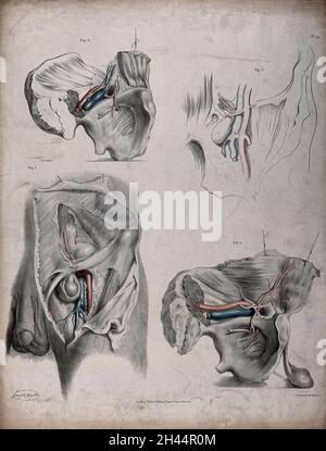 Le système circulatoire : dissection du système reproducteur mâle et de l'os pelvien, avec les artères et les veines indiquées en rouge et en bleu.Lithographie colorée par J. Maclise, 1841/1844. Banque D'Images