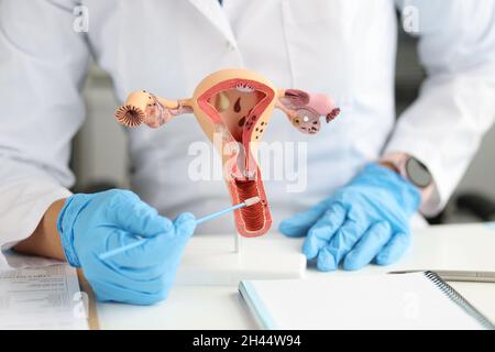 Le gynécologue détient des cytobrosses urogénitales et un modèle de système reproducteur féminin Banque D'Images