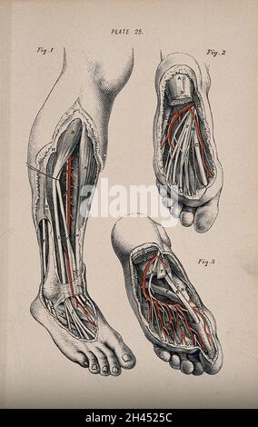 Dissection du pied et de la jambe inférieure : trois figures, montrant les tendons, les muscles et les vaisseaux sanguins.Gravure en bois de couleur avec typographie, 1860/1900? Banque D'Images