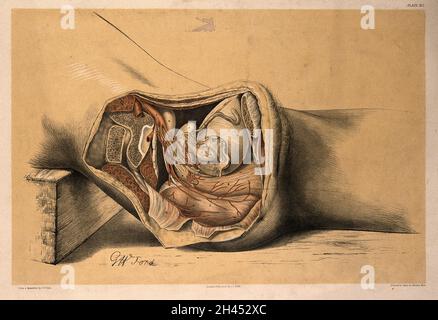 Dissection du bassin d'un homme, montrant les artères, les vaisseaux sanguins, les muscles et les organes internes: Vue latérale.Lithographie par G.H.Ford, 1866. Banque D'Images