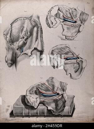 Le système circulatoire : dissection du système reproducteur mâle et de l'os pelvien, avec les artères et les veines indiquées en rouge et en bleu.Une dissection est montrée reposant sur un livre de C. Bell.Lithographie colorée par J. Maclise, 1841/1844. Banque D'Images