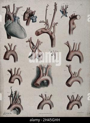 Le système circulatoire : dissection montrant l'aorte, les artères, les veines et le cœur, avec les artères et les veines indiquées en rouge et en bleu.Lithographie colorée par J. Maclise, 1841/1844. Banque D'Images