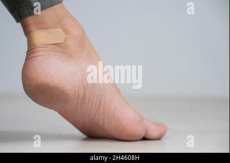 Une femme scelle un maïs sur sa jambe avec un plâtre. La jeune fille a frotté sa jambe avec des chaussures inconfortables. Banque D'Images