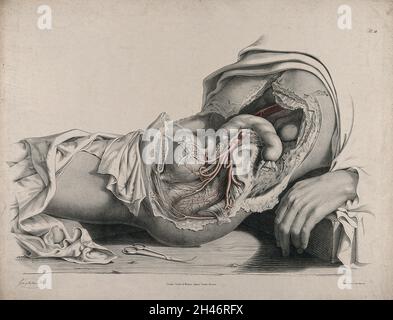 Le système circulatoire: Dissection de l'abdomen et région pelvienne d'une femme, vue latérale, montrant les intestins et la vessie (?), avec les artères indiquées en rouge.Une paire de ciseaux chirurgicaux est illustrée ci-dessous.Lithographie colorée par J. Maclise, 1841/1844. Banque D'Images