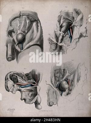 Le système circulatoire : dissection du système reproducteur masculin, avec les artères et les veines indiquées en rouge et en bleu.Lithographie colorée par J. Maclise, 1841/1844. Banque D'Images