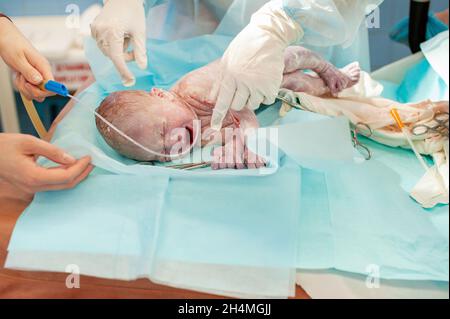 un nouveau-né repose sur la table d'opération pour l'accouchement immédiatement après la naissance. Banque D'Images