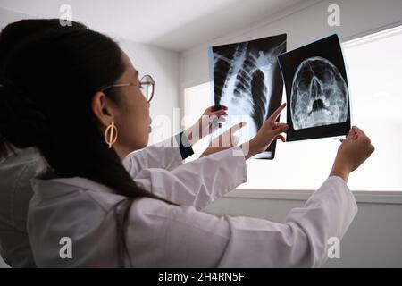 Deux médecins examinant un crâne et des images radiologiques de côtes. Banque D'Images