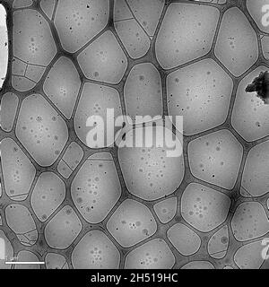Nanoparticules d'image composées de lipides (liposomes) contenant un médicament anticancéreux Banque D'Images