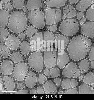 Image électronique de nanoparticules en lipides contenant un médicament anticancéreux (doxorubicine) Banque D'Images