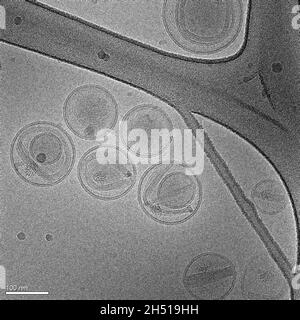 Image électronique de nanoparticules composées de lipides contenant un médicament anticancéreux Banque D'Images