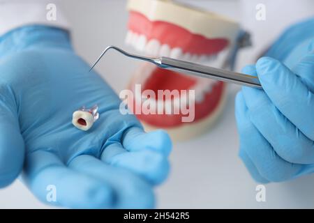 Dentiste médecin tenant une dent en plastique artificiel dans ses mains sur le fond de la mâchoire de gros plan Banque D'Images