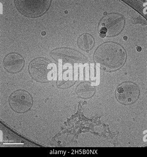 L'image électronique représente plusieurs nanoparticules de lipides (liposomes) Banque D'Images