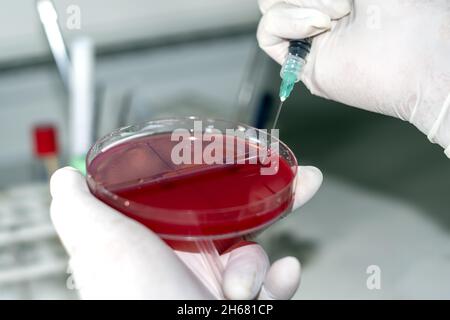 agar medio de cultivo de laboratorio clínico microbiología Banque D'Images