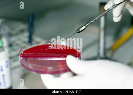 agar medio de cultivo de laboratorio clínico microbiología Banque D'Images