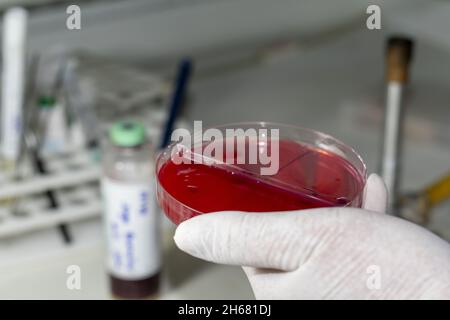 agar medio de cultivo de laboratorio clínico microbiología Banque D'Images