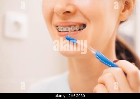 Jeune femme avec des bretelles sur ses dents brossant ses dents avec une brosse dentaire spéciale, gros plan. Banque D'Images