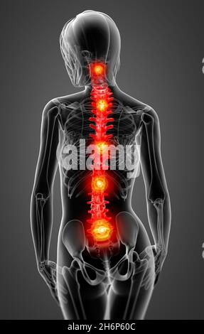 3d rendered illustration of the female spine bone - back view Stock Photo