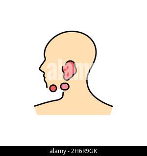 Inflammation des ganglions lymphatiques sous-mandibulaires icône de couleur.Maladies humaines.Pictogramme pour page Web, application mobile, Promo. Illustration de Vecteur