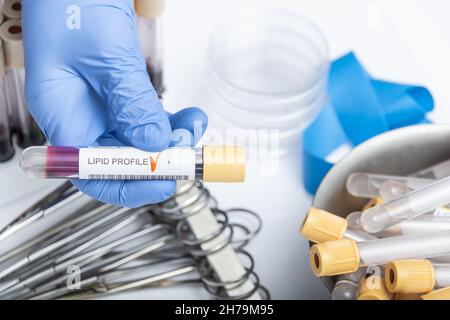 Échantillon de sang pour le test du profil lipidique. Technologie médicale Banque D'Images