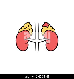 icône de la ligne de couleur du syndrome de cortisol de précipitation.Maladies humaines. Illustration de Vecteur