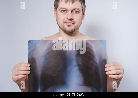 Un homme tient une image radiologique de ses poumons au niveau de la poitrine Banque D'Images