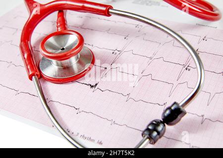 Rapport d'Écocardiographie (ECG) montrant un battement de coeur irrégulier avec un stéthoscope rouge sur le dessus Banque D'Images