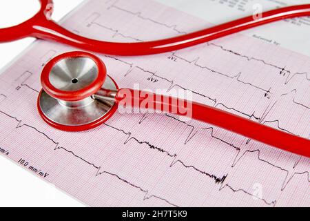 Rapport d'Écocardiographie (ECG) montrant un battement de coeur irrégulier avec un stéthoscope rouge sur le dessus Banque D'Images