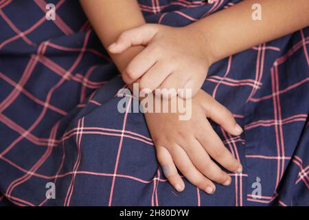 enfant fille souffrant de la peau de démangeaisons, gros plan. Banque D'Images