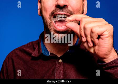 Jeune homme caucasien beau, contre le mur bleu tenant un aligneur invisible amovible Banque D'Images