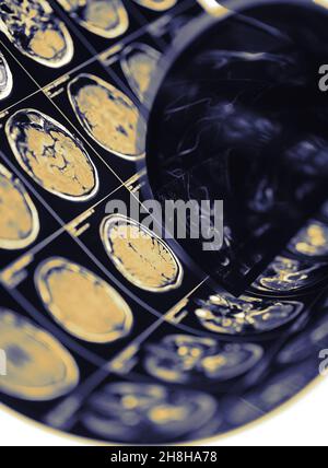 Image CT du cerveau humain comme concept d'inspection diagnostique. Banque D'Images