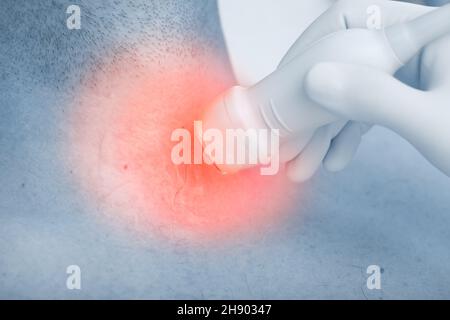 Сoncept d'échographie diagnostic de la maladie dans la lésion au cours d'une visite dans la clinique ambulatoire. Banque D'Images