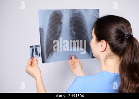 Le médecin compare les images des poumons humains sur un petit fluorogramme et une image radiologique. Banque D'Images