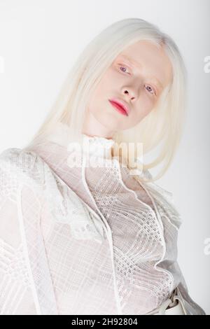 Portrait de la jeune femme albino regardant loin isolée sur blanc Banque D'Images