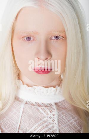 Portrait d'une femme albino regardant l'appareil photo isolé sur blanc Banque D'Images