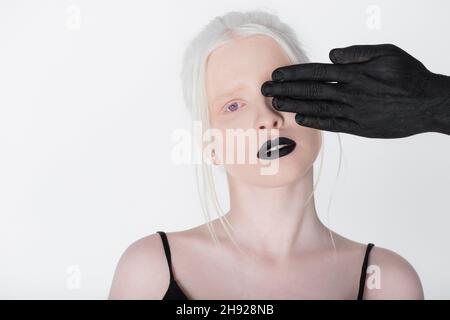 Main mâle dans la peinture noire couvrant l'œil de la femme albino isolée sur blanc Banque D'Images