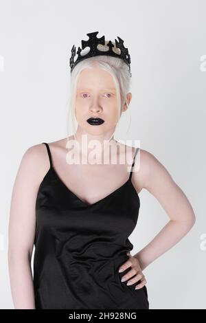 Jolie femme albino en robe noire et couronne regardant la caméra isolée sur blanc Banque D'Images