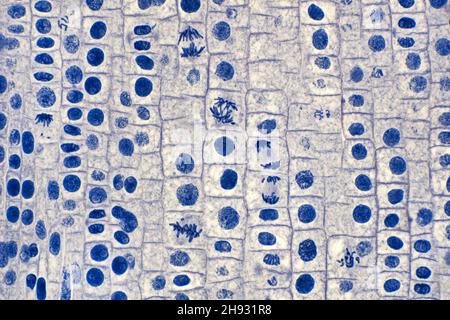 Mitose de la pointe de la racine de l'oignon, division cellulaire, photomicrographe à fond clair Banque D'Images