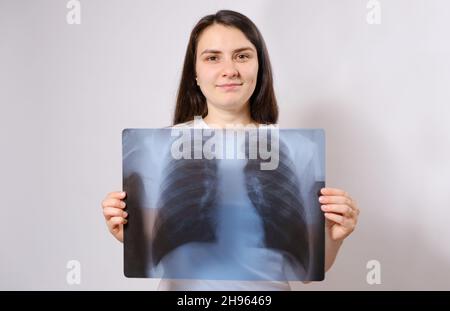 La femme tient une image radiologique de ses poumons au niveau de la poitrine Banque D'Images