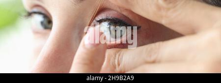 La jeune femme met sur les lentilles de contact de près Banque D'Images