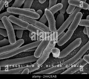 Les bactéries E. coli Banque D'Images