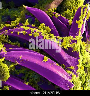 Balayage du micrographe électronique de Yersinia pestis, qui cause la peste bubonique, sur les épines proventriculaires d'une puce de Xenopsyla cheopis. Banque D'Images