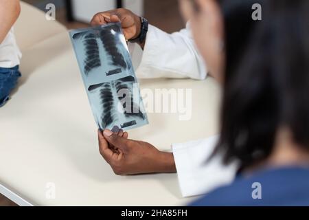 Gros plan du pédiatre afro-américain tenant la radiographie pulmonaire en main discutant des résultats médicaux lors de la consultation dans le bureau de l'hôpital.Thérapeute homme analysant la radiographie.Service de médecine Banque D'Images