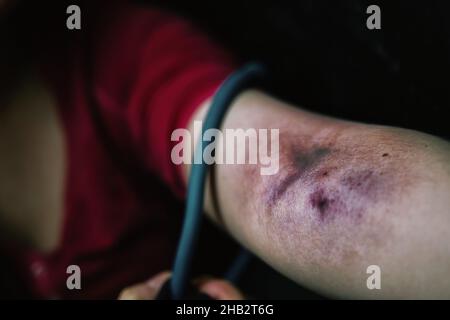 Fille adulte avec des dreadlocks avant de prendre la dose de stupéfiant dans la veine. Banque D'Images
