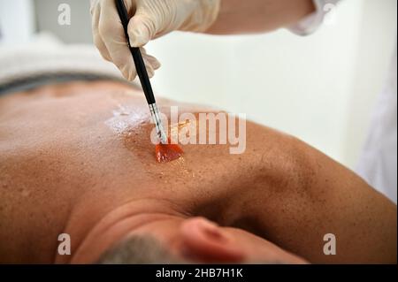 Gros plan d'un homme mature caucasien allongé sur une table de massage, tandis que les mains d'un esthéticien tiennent une brosse et appliquent de l'huile de massage sur son dos avant ge Banque D'Images