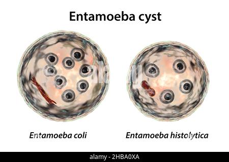 Kystes d'Entamoeba protozoans, E. coli et E. histolityca, illustration informatique.E. coli est un amibe non pathogène, son kyste est de 15-25 micromètres, possède huit noyaux et une barre chromatoïdale allongée avec des extrémités fracturées (rouge foncé).E. histolytica est un protozoaire parasite qui provoque une dysenterie amibienne chez l'homme après l'ingestion de kystes infectieux dans des aliments ou de l'eau contaminés.Le kyste mature de E. histolytica est de 10-20 micromètres, possède quatre noyaux et une barre chromatoïdale allongée arrondie (rouge foncé). Banque D'Images